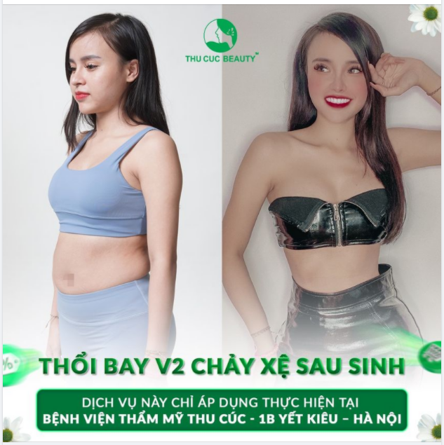 SAU SINH EO VẪN THON GỌN - BÍ QUYẾT LÀ ĐÂY!