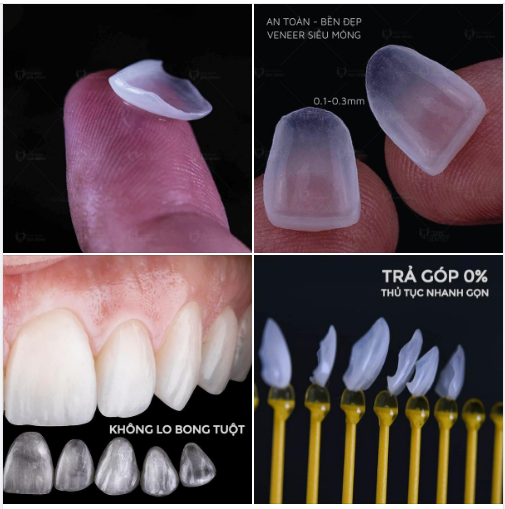 SIÊU MỎNG - BỀN CHẮC  - KHÔNG LO BONG TUỘT