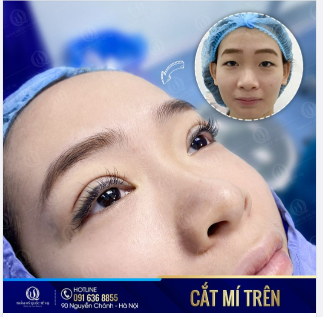 SIÊU PHẨM được thực hiện trong vòng 15p, thay đổi hoàn toàn thần thái đôi mắt của bạn KH