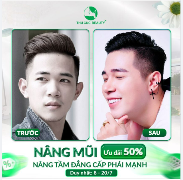 "SIÊU PHẨM" NÂNG MŨI CHO KH NAM - THÊM BỘI PHẦN VẺ NAM TÍNH CUỐN HÚT