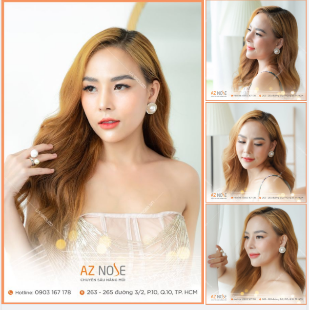 Sline cao - Dáng mũi chưa bao giờ "hạ nhiệt"