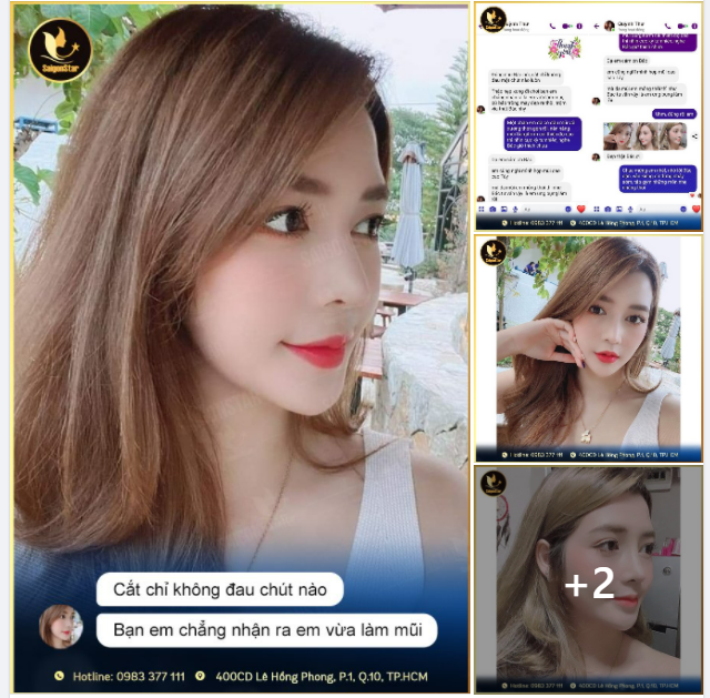 SỞ HỮU DÁNG MŨI XINH- RINH NGAY FEEDBACK XỊN