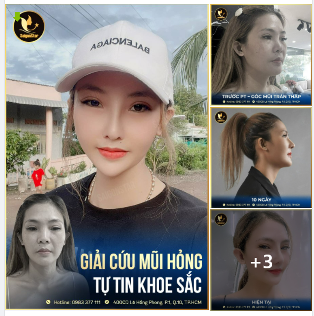 SỞ HỮU MŨI XINH - NHAN SẮC LUNG LINH