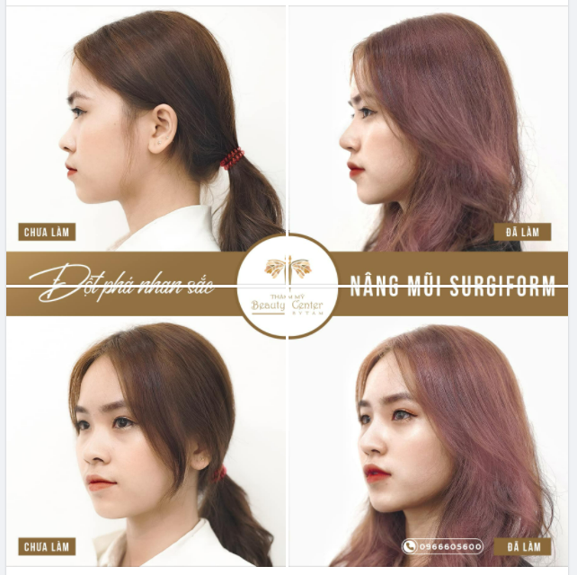 Sở hữu vẻ đẹp vừa đạt chuẩn vừa là "của riêng "