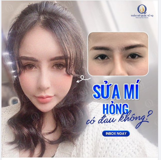 Sửa lại mí hỏng có đau không