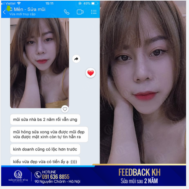 Sửa mũi đã mang lại cho bạn những gì?