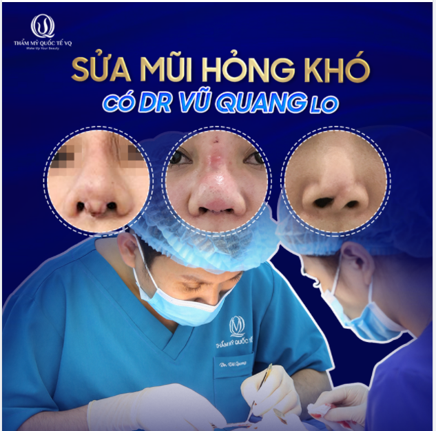 SỬA MŨI HỎNG KHÓ - CÓ DR VŨ QUANG LO
