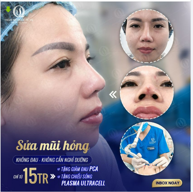 SỬA MŨI HỎNG KHÔNG ĐAUU, KHÔNG CẦN NGHỈ DƯỠNG CHỈ TỪ 15TRIEU