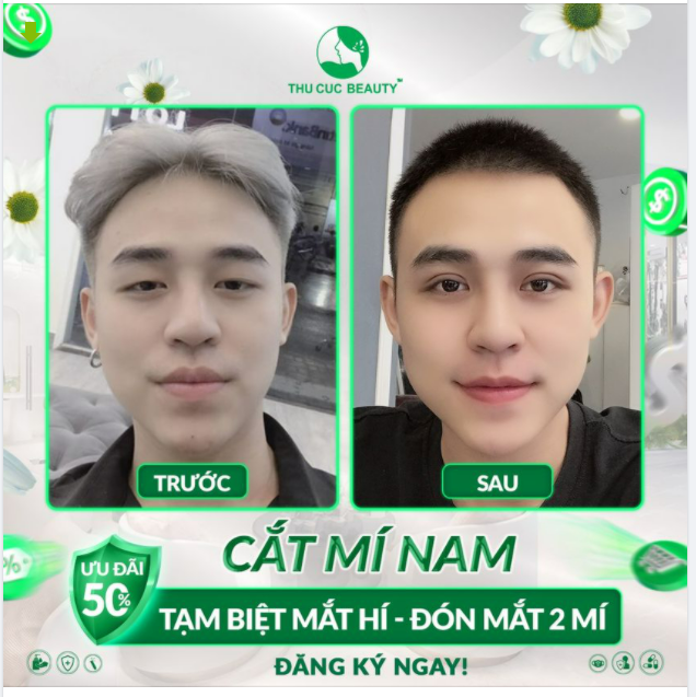 TẠM BIỆT MẮT HÍ - ĐÓN MẮT 2 MÍ