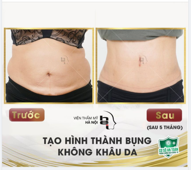 Tạm biệt thân hình quả lê Ta cùng đón nhận thân hình đồng hồ cát.