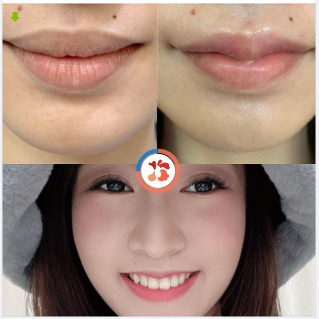 TẠO HÌNH MÔI TIM - Chúm chím yêu kiều