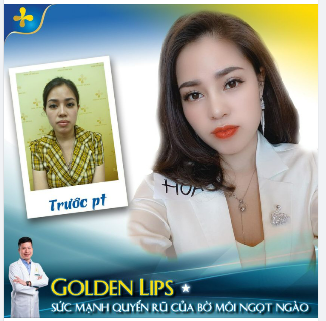 TẠO HÌNH MÔI TRÁI TIM Sở hữu dáng môi như ý và vô cùng gợi cảm sau một lần phẫu thuật duy nhất.