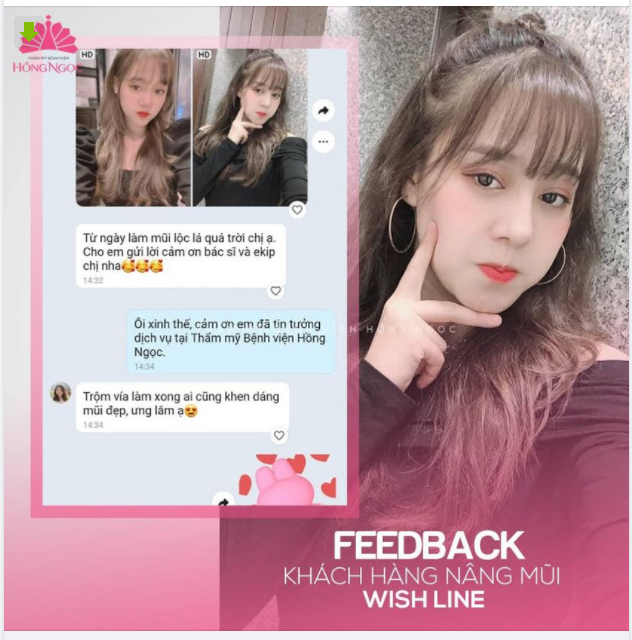 Thả 1 chiếc Feedback ngọt ngào từ Khách hàng Huyền Nhi sau Nâng Mũi Wish Line
