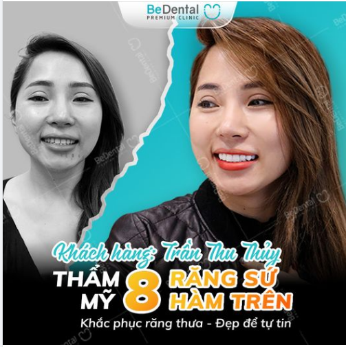 THẨM MỸ RĂNG SỨ - ĐẸP ĐỂ TỰ TIN