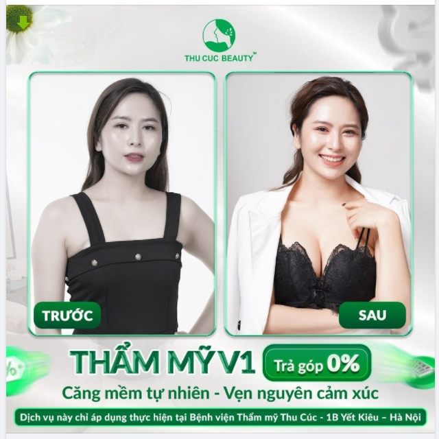 THẨM MỸ V1 TRẢ GÓP 0% CĂNG MỀM TỰ NHIÊN - VẸN NGUYÊN CẢM XÚC