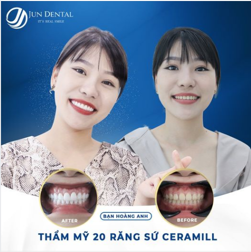 THĂNG HẠNG NHAN SẮC NHỜ THẨM MỸ RĂNG SỨ - CÔ NÀNG NHÂN VIÊN SALE TỰ TIN "CHỐT ĐƠN" ẦM ẦM