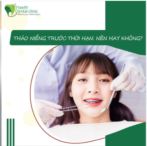 THÁO NIỀNG TRƯỚC THỜI HẠN: NÊN HAY KHÔNG?