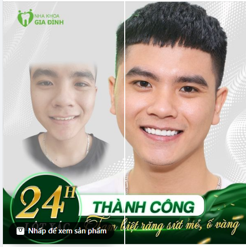 ​THAY ĐỔI BẤT NGỜ - CƯỜI ĐẸP NHƯ MƠ