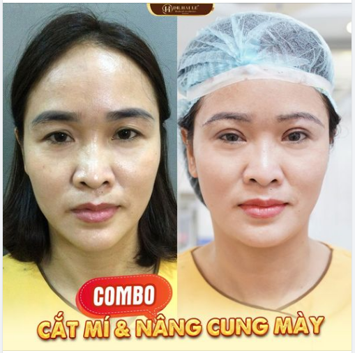 THAY ĐỔI HOÀN HẢO VỚI COMBO CẮT MÍ & NÂNG CUNG MÀY