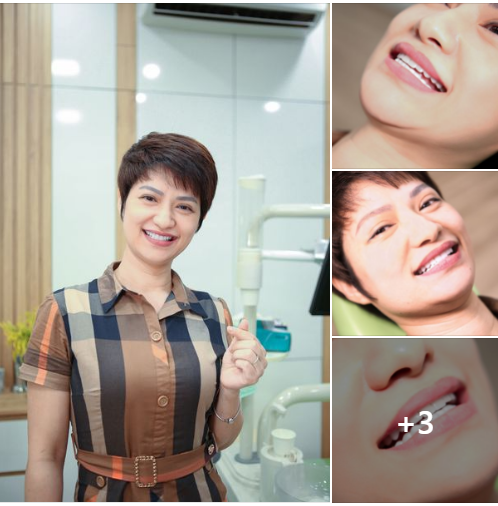 THAY ĐỔI NỤ CƯỜI – NÉT DUYÊN BỪNG SÁNG