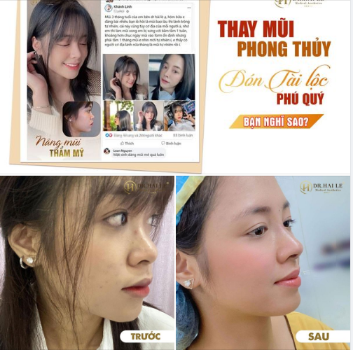 THAY MŨI PHONG THỦY - ĐÓN TÀI LỘC PHÚ QUÝ. BẠN NGHĨ SAO