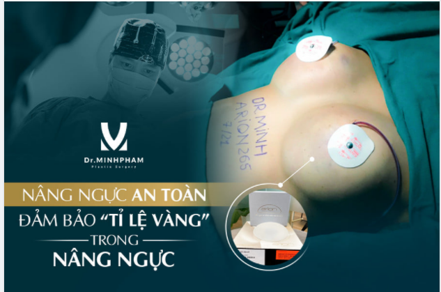 THẾ NÀO LÀ NÂNG NGỰC CHUẨN TỶ LỆ VÀNG?