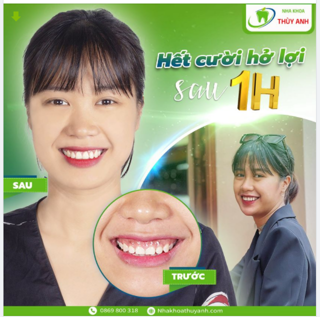 THỎA SỨC CƯỜI TƯƠI KHÔNG LO HỞ LỢI
