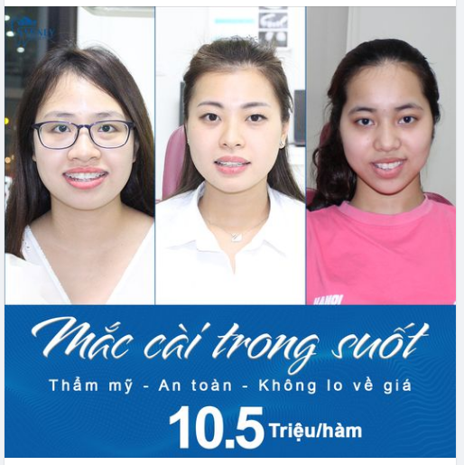 THỜI GIAN NIỀNG RĂNG CHỊU ẢNH HƯỞNG TỪ CÁC YẾU TỐ NÀO 