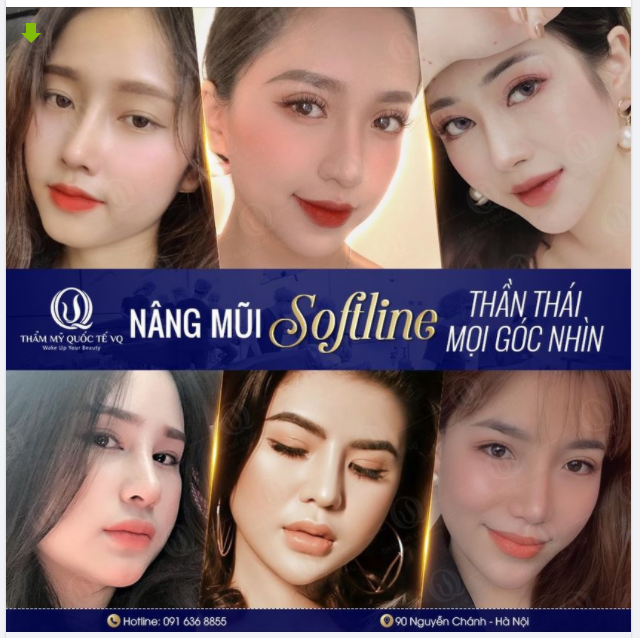 Thu hút mọi ánh nhìn cùng các siêu phẩm mũi SOFTLINE qua từng năm tháng
