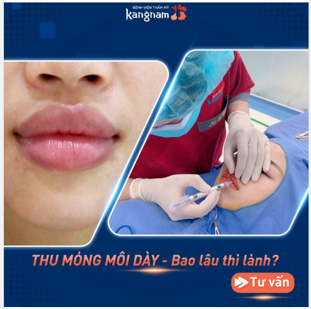Thu mỏng môi dày bao lâu thì lành?