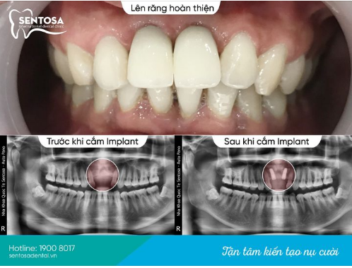 TÔI KHÔNG CƯỜI – TÔI CŨNG NGẠI MỞ LỜI NÓI CHUYỆN