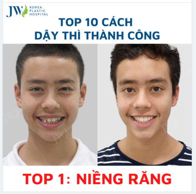 Top 10 cách dậy thì thành công