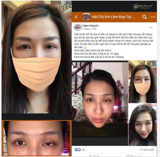TRĂM LỜI QUẢNG CÁO KHÔNG BẰNG 1 FEEDBACK CHÂN THỰC