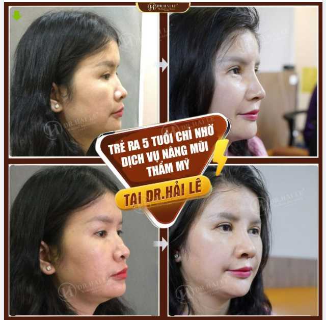 TRẺ RA 5 TUỔI NHỜ THỰC HIỆN 1 DỊCH VỤ BẠN CÓ TIN KHÔNG???