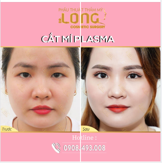 ​​​​​​​TRỞ NÊN LỘT XÁC XINH ĐẸP ĐẾN KHÓ TIN...NHƯNG PHẢI TIN VÌ ĐÓ LÀ SỰ THẬT