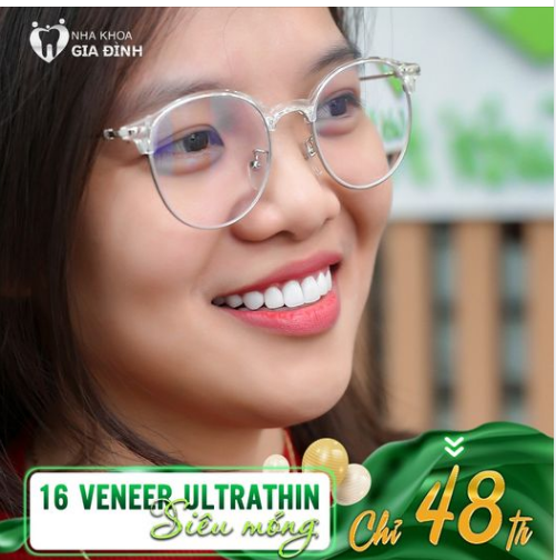 TRỌN BỘ 16 VENEER ULTRATHIN CAO CẤP NAY CHỈ 48TR