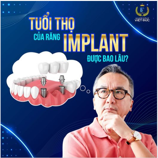 Trồng Implant là giải pháp toàn diện để phục hình lại răng bị mất mang nhiều ưu điểm vượt trội hơn so với cầu răng sứ hay hàm giả tháo lắp.