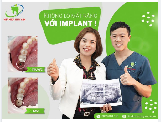 TRỒNG LẠI RĂNG MẤT QUAN TRỌNG ĐẾN THẾ NÀO?