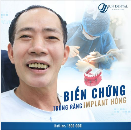 TRỒNG RĂNG IMPLANT CÓ THỂ HỎNG KHÔNG?