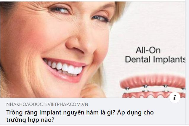 TRỒNG RĂNG IMPLANT NGUYÊN HÀM LÀ GÌ?