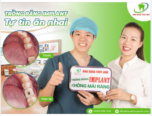 TRỒNG RĂNG MỘT LẦN - ĂN NHAI TRỌN ĐỜI