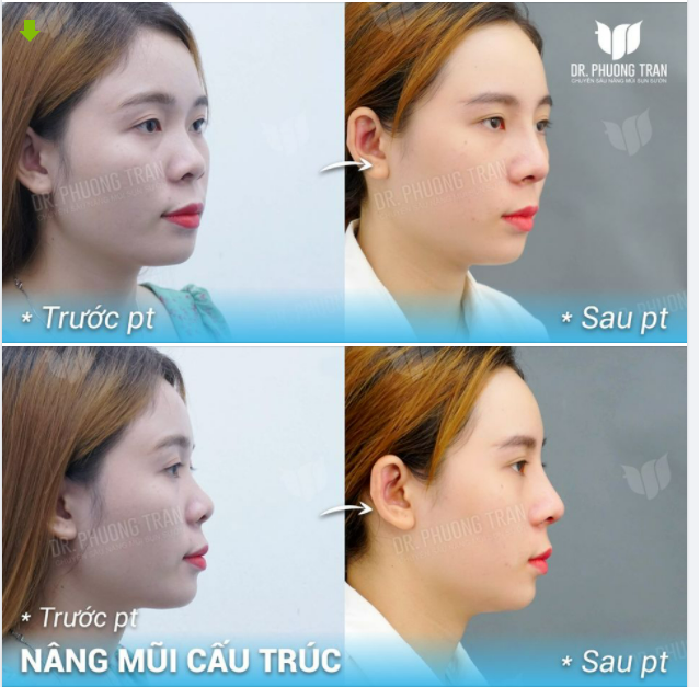 Trứng rán cần mỡ, bắp cần bơ Xinh hông cần cớ, cần bác sĩ cơ!