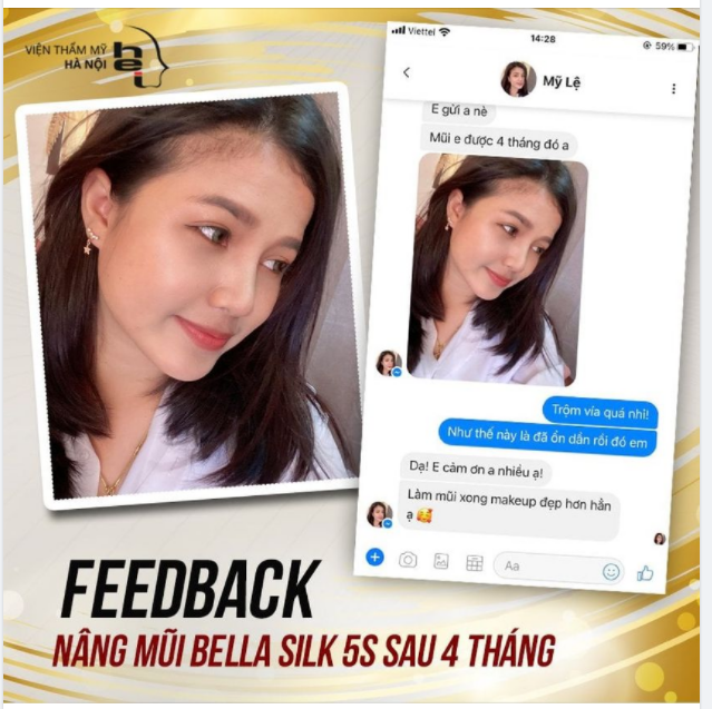 "Từ ngày nâng mũi, makeup sương sương thôi cũng thấy xinh rồi!"