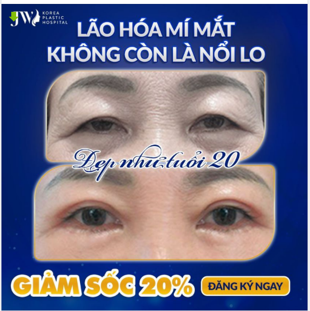 Tuổi tác không còn là nỗi lo, hồi xuân đôi mắt, trẻ ngay 10 tuổi