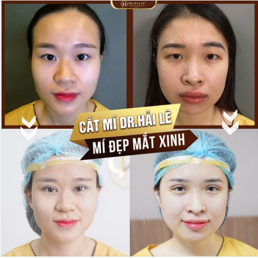 Tus dành riêng cho cô nàng mắt 1 mí, mí lót