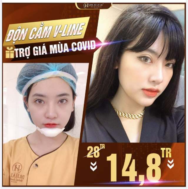 Tus dành riêng cho tín đồ làm đẹp Cằm V-line