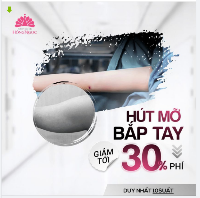 ƯU ĐÃI BẤT NGỜ - CÒN CHẦN CHỜ CHI