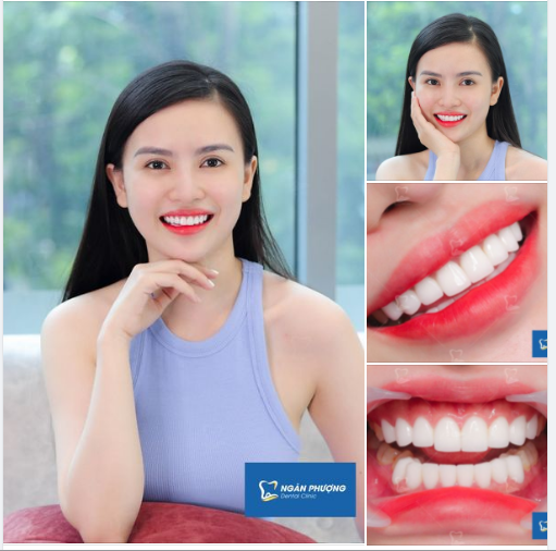 "Vì nụ cười là thứ trang sức quý giá nhất