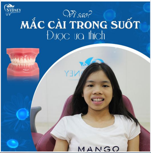 VÌ SAO MẮC CÀI TRONG SUỐT ĐƯỢC ƯA THÍCH