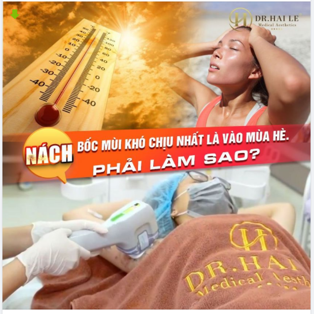 VÌ SAO NÊN ĐIỀU TRỊ MỒ HÔI NÁCH "CÀNG SỚM CÀNG TỐT"?